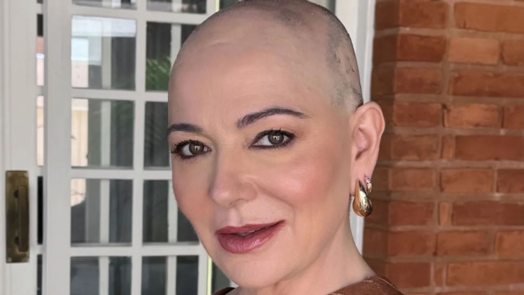 Mãe de Lucas Lucco exibe nova fase durante tratamento contra alopecia: ‘Autoestima’