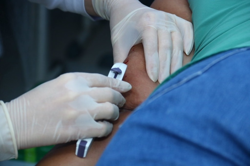 Implanon: Prefeitura de Sinop recebe 5,8 mil implantes e reforça oferta de contraceptivo nas UBS